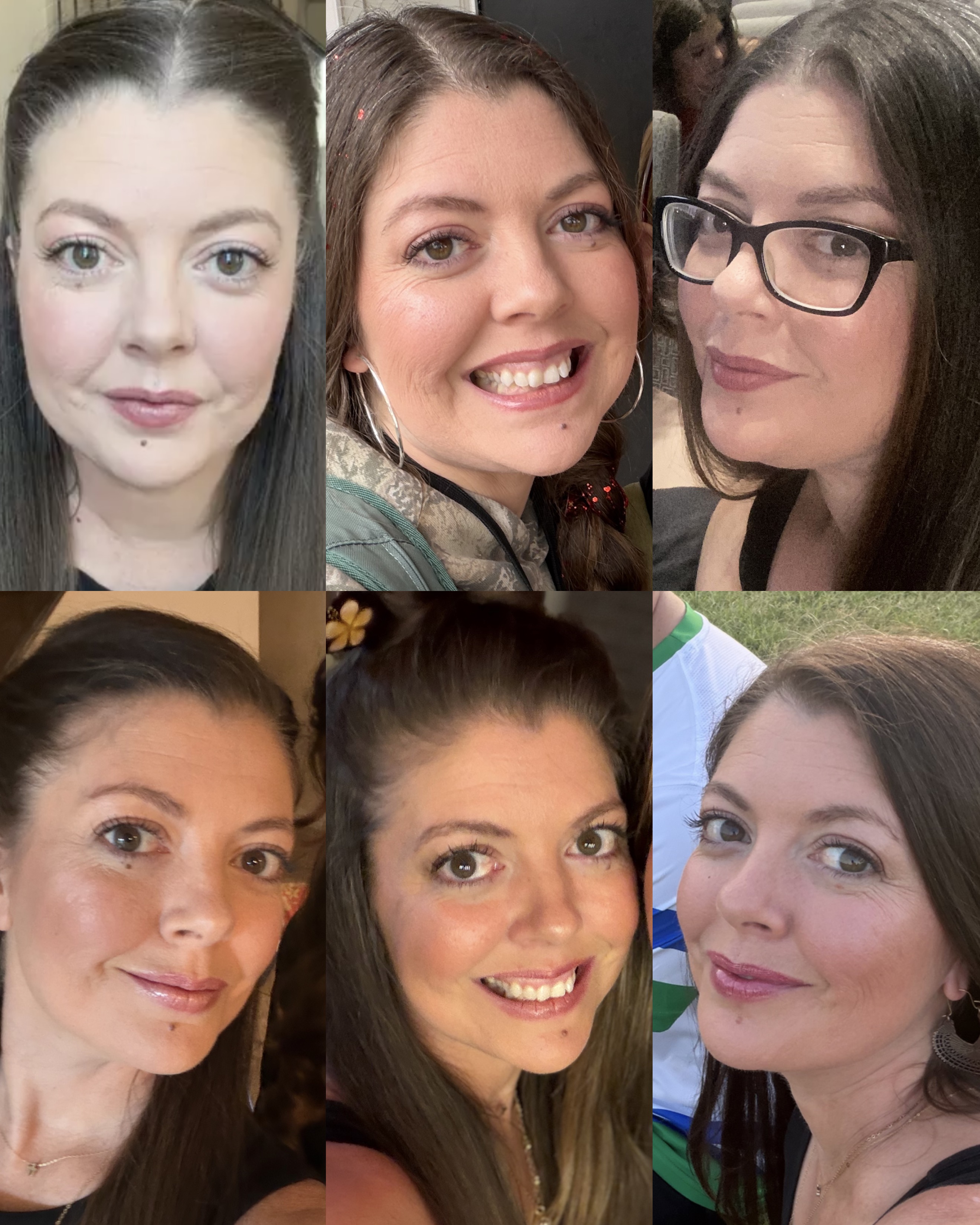 Grid of Melissa's face before (top row) and after (bottom row) showing reduced facial puffiness