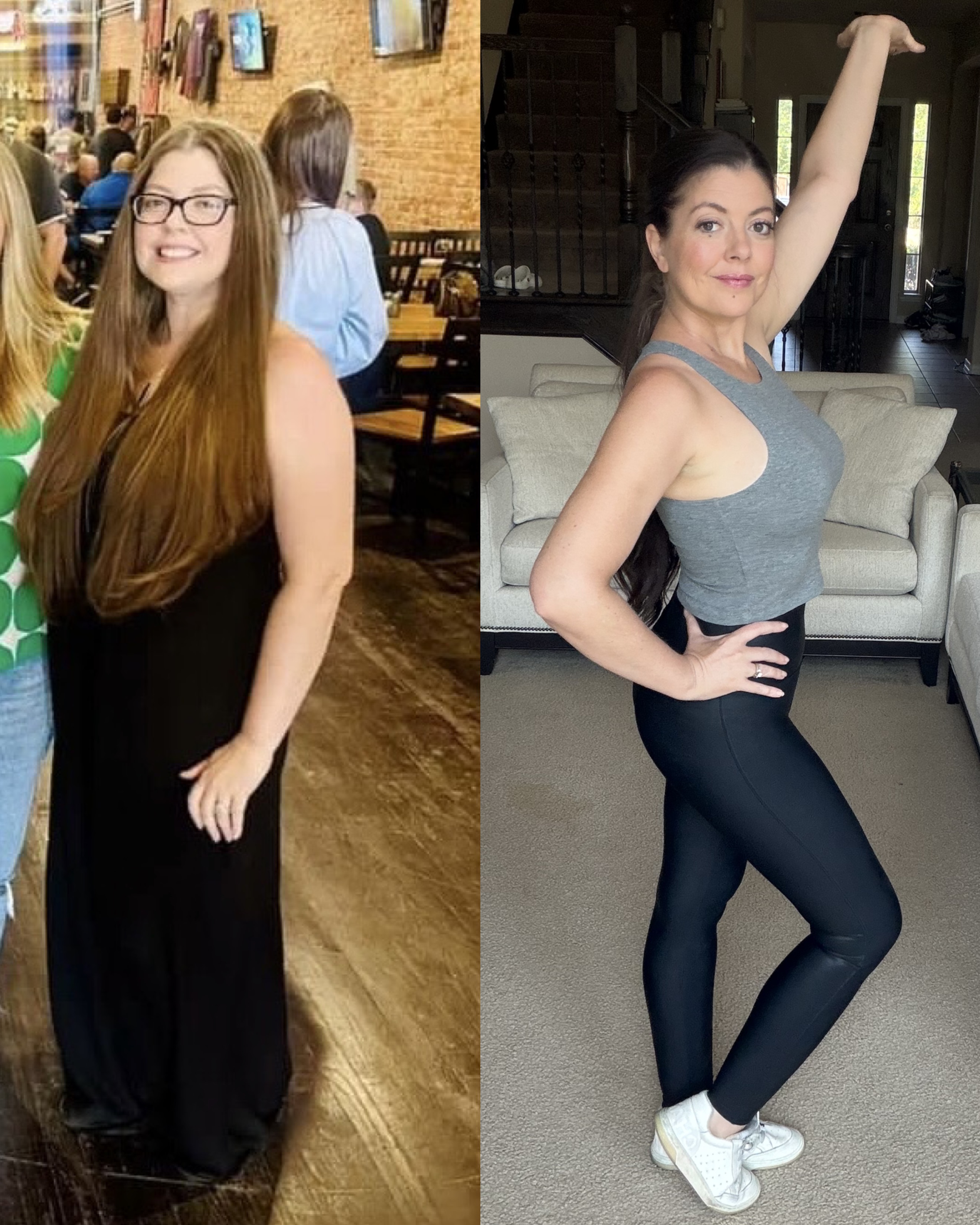 Melissa before and after, showing the contrast in facial inflammation and overall appearance